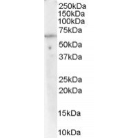 Western Blot (0.03μg/ml) staining of Human Lymph Node lysate (35μg protein in RIPA buffer). Primary incubation was 1 hour. Detected by chemiluminescence.