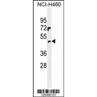 Western blot analysis in NCI-H460 cell line lysates (35ug/lane).