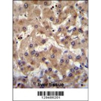 PRAMEF6 Antibody immunohistochemistry analysis in formalin fixed and paraffin embedded human liver tissue followed by peroxidase conjugation of the secondary antibody and DAB staining.