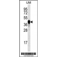 Western blot analysis in uterus tumor cell line lysates (35ug/lane).