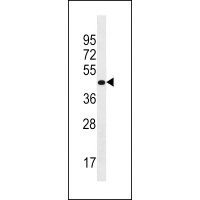 Western blot analysis in Uterus tissue lysates (35ug/lane).