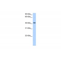Antibody used in WB on Human Placenta at 2.5 ug/ml.