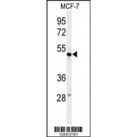 Western blot analysis of PSG7 Antibody in MCF-7 cell line lysates (35ug/lane)