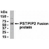 E coli-derived fusion protein as test antigen. Affinity-purified IgY dilution: 1:2000, Goat anti-IgY-HRP dilution: 1:1000. Colorimetric method for signal development.