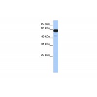 Antibody used in WB on Human Brain at 0.2-1 ug/ml.