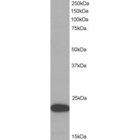 Western Blot (1μg/ml) staining of HeLa lysate (35μg protein in RIPA buffer). Primary incubation was 1 hour. Detected by chemiluminescence.