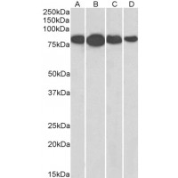 Western Blot (0.01μg/ml) staining of NIH3T3 (A), HeLa (B), Jurkat (C), and A431 (D) lysates (35μg protein in RIPA buffer). Primary incubation was 1 hour. Detected by chemiluminescence.