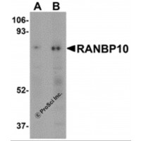 Western blot analysis of RANBP10 in human skeletal muscle tissue lysate with RANBP10 antibody at (A) 1 and (B) 2 μg/mL.