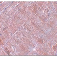 Immunohistochemistry of RANBP10 in human skeletal muscle tissue with RANBP10 antibody at 5 μg/mL.