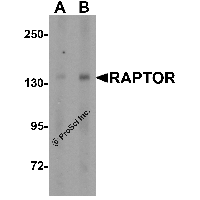Western blot analysis of RAPTOR expression in Jurkat cell lysate with RAPTOR antibody at (A) 1 and (B) 2 μg/ml.