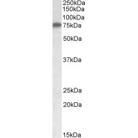 Western Blot (1μg/ml) staining of HepG2 lysate (35μg protein in RIPA buffer). Primary incubation was 1 hour. Detected by chemiluminescence.