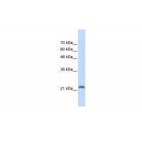 Antibody used in WB on Transfected 293T at 0.2-1 ug/ml.