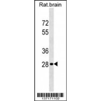 Western blot analysis in rat brain tissue lysates (35ug/lane).This demonstrates detected the Hoxd9 protein (arrow).