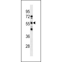 Western blot analysis in NCI-H460 cell line lysates (35ug/lane).
