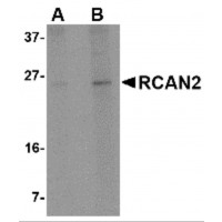 Western blot analysis of RCAN2 in 3T3 cell lysate with RCAN2 antibody at (A) 1 and (B) 2 μg/mL.