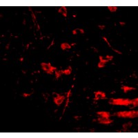 Immunofluorescence of RCAN2 in mouse brain tissue with RCAN2 antibody at 20 μg/mL.