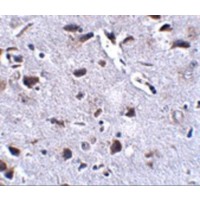 Immunohistochemistry of RCAN2 in mouse brain tissue with RCAN2 antibody at 2.5 μg/mL.