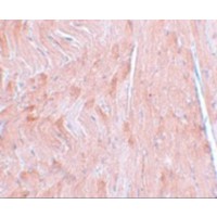 Immunohistochemistry of REEP3 in mouse heart tissue with REEP3 antibody at 5 μg/mL.