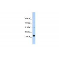 Antibody used in WB on Transfected 293T at 0.2-1 ug/ml.