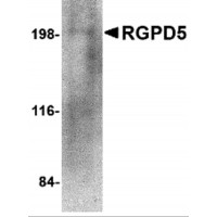 Western blot analysis of RGPD5 in human thymus tissue lysate with RGPD5 antibody at 1 μg/mL.