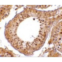 Immunohistochemistry of RGPD5 in human testis tissue cells with RGPD5 antibody at 10 μg/mL.