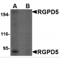 Western blot analysis of RGPD5 in human thymus tissue lysate with RGPD5 antibody at 1 μg/mL in (A) the absence and (B) the presense of blocking peptide.
