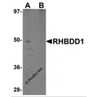 Western blot analysis of RHBDD1 in K562 cell lysate with RHBDD1 antibody at 1 μg/mL in (A) the absence and (B) the presence of blocking peptide.