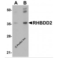 Western blot analysis of RHBDD2 in rat lung tissue lysate with RHBDD2 antibody at (A) 1 and (B) 2 μg/mL.