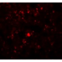 Immunofluorescence of RHBDD2 in Rat Lung cells with RHBDD2 antibody at 20 μg/mL.