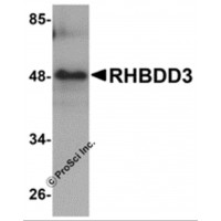 Western blot analysis of RHBDD3 in rat lung tissue lysate with RHBDD3 antibody at 1 μg/mL.