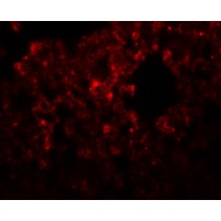 Immunofluorescence of RHBDD32 in rat lung tissue with RHBDD3 antibody at 20 μg/mL.