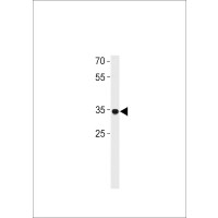Western blot analysis in A549 cell line lysates (35ug/lane).