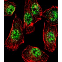 Fluorescent confocal image of A549 cell stained with RHOXF2B Antibody .A549 cells were fixed with 4% PFA (20 min), permeabilized with Triton X-100 (0.1%, 10 min), then incubated with RHOXF2B primary antibody (1:25). For secondary antibody, Alexa Fluor 488 conjugated donkey anti-rabbit antibody (green) was used (1:400).Cytoplasmic actin was counterstained with Alexa Fluor 555 (red) conjugated Phall