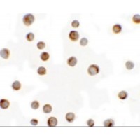 Immunocytochemistry of RILP in HeLa cells with RILP antibody at 2.5 μg/mL.