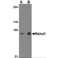 Western blot analysis of Rkhd1 in MDA-MB-361 cell lysate with Rkhd1 antibody at (A) 1 μg/ml and (B) 2 μg/mL.