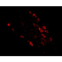 Immunofluorescence of rkhd1 in human small intestine tissue with rkhd1 antibody at 20 μg/mL.