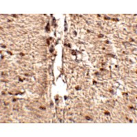 Immunohistochemistry of Rkhd1 in human small intestine tissue with Rkhd1 antibody at 2.5 μg/mL.