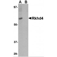 Western blot analysis of Rkhd4 in SK-N-SH cell lysate with Rkhd4 antibody at 1 μg/mL in (A) the absence and (B) the presence of blocking peptide.