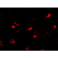 Immunofluorescence of rkhd4 in human brain tissue with rkhd4 antibody at 20 μg/mL.