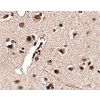 Immunohistochemistry of Rkhd4 in human brain tissue with Rkhd4 antibody at 2.5 μg/mL.