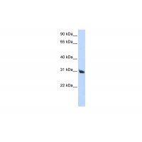 Antibody used in WB on Human Placenta at 0.2-1 ug/ml.