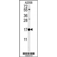 Western blot analysis in A2058 cell line lysates (35ug/lane). This demonstrates the RNASEK antibody detected the RNASEK protein (arrow).