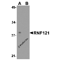 Western blot analysis of RNF121 in MCF7 cell lysate with RNF121 antibody at 1 μg/ml in (A) the absence and (B) the presence of blocking peptide.