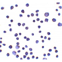 Immunocytochemistry of RNF121 in MCF7 cells with RNF121 antibody at 10 μg/ml.