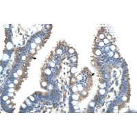 Antibody used in IHC on Human Intestine.