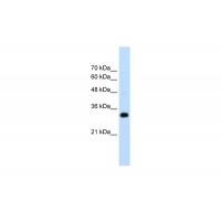 Antibody used in WB on Human HepG2 at 1.25 ug/ml.
