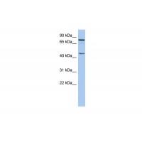 Antibody used in WB on Human THP-1 at 0.2-1 ug/ml.