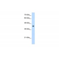Antibody used in WB on Human Jurkat 2.5 ug/ml.
