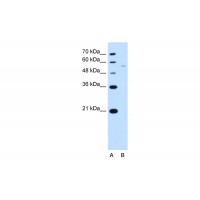 Antibody used in WB on Human Jurkat cells at 2.5 ug/ml.