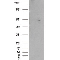 HEK293 overexpressing RXRB and probed with antibody (mock transfection in first lane).